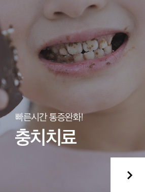 충치치료
