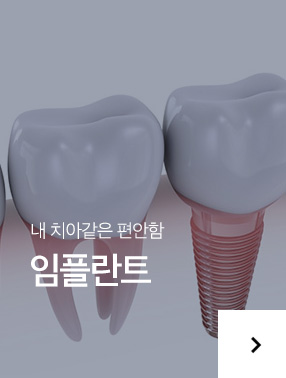 임플란트