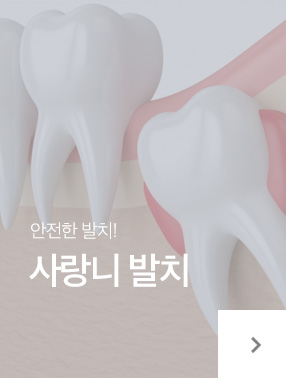 사랑니발치